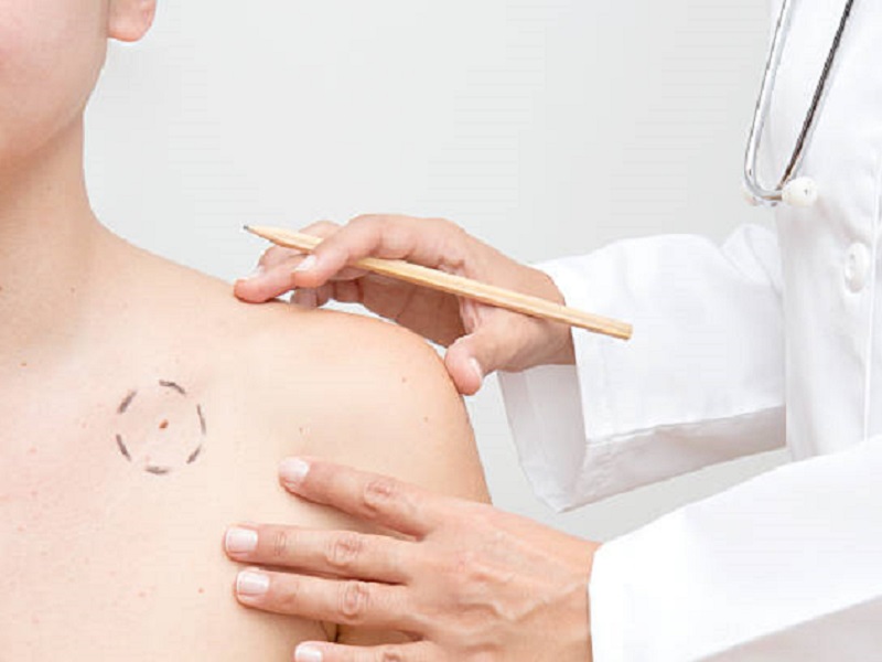 სოფო ლილუაშვილი