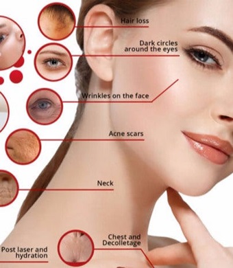 პლაზმოთერაპია